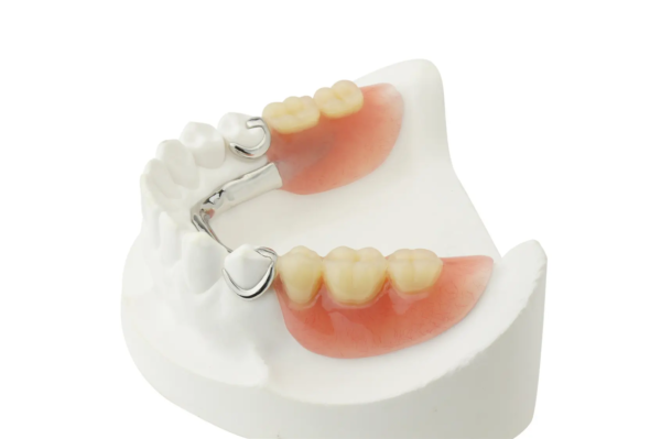 Removable Denture